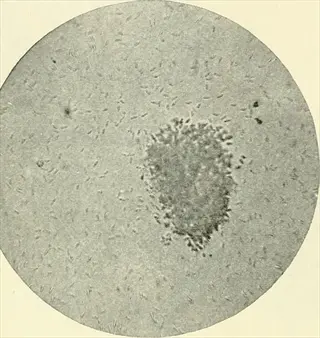microscope view of anthracnose spore masses clustered on a pale circular field